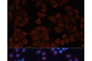 Immunofluorescence (IF) image for anti-ADAM Metallopeptidase Domain 12 (ADAM12) antibody (ABIN7263989)