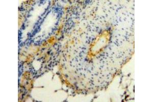 Used in DAB staining on fromalin fixed paraffin-embedded Lung tissue (JAM2 抗体  (AA 74-250))