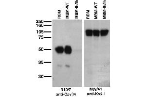 Immunoblot on adult rat brain membrane (RBM), and adult mouse brain membranes (MBM) from wild-type (WT) and lethargic (lh/lh) mice (left) Lethargic mice courtesy of Dr.