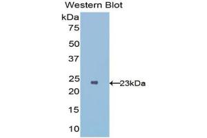 Western blot analysis of the recombinant protein. (IL1RL1 抗体  (AA 162-349))