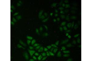 Figure. (QSOX1 抗体  (AA 394-519))