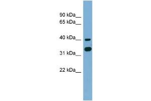 WB Suggested Anti-GPN2 Antibody Titration: 0. (GPN2 抗体  (Middle Region))