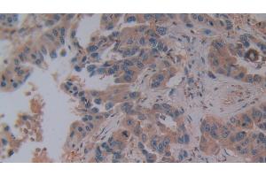 Immunohistochemistry (IHC) image for anti-Secreted phosphoprotein 1 (SPP1) (AA 18-314) antibody (ABIN7442486)
