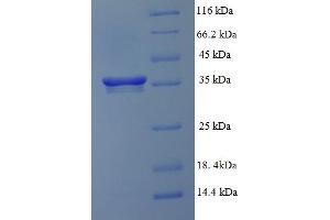 SDS-PAGE (SDS) image for GC-Rich Promoter Binding Protein 1 (GPBP1) (AA 293-473), (partial) protein (His-SUMO Tag) (ABIN4974672) (GC-Rich Promoter Binding Protein 1 (GPBP1) (AA 293-473), (partial) protein (His-SUMO Tag))