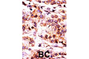 Immunohistochemistry (IHC) image for anti-Pantothenate Kinase 1 (PANK1) antibody (ABIN3003019) (PANK1 抗体)