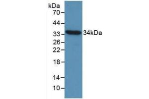 Detection of Recombinant CCND1, Gallus using Monoclonal Antibody to Cyclin D1 (CCND1) (Cyclin D1 抗体  (AA 1-292))