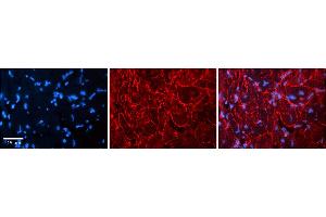 Immunohistochemistry (IHC) image for anti-Small Conductance Calcium-Activated Potassium Channel Protein 3 (KCNN3) (C-Term) antibody (ABIN2776146)