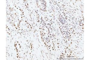 IHC analysis of KIFC1 using anti-KIFC1 antibody (ABIN7599523).