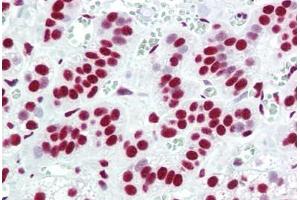 anti-Apoptotic Chromatin Condensation Inducer 1 (ACIN1) antibody