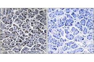 Immunohistochemistry (IHC) image for anti-Protein Phosphatase, Mg2+/Mn2+ Dependent, 1K (PPM1K) (AA 205-254) antibody (ABIN1535225)