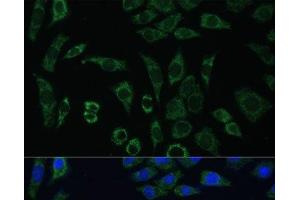 Immunofluorescence analysis of L929 cells using AEBP1 Polyclonal Antibody at dilution of 1:100 (40x lens). (AEBP1 抗体)