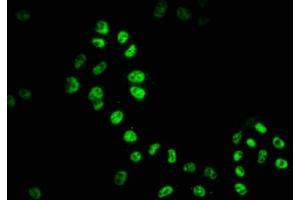 Immunofluorescence staining of Hela cells with ABIN7127541 at 1:51, counter-stained with DAPI. (Recombinant HDAC9 抗体)