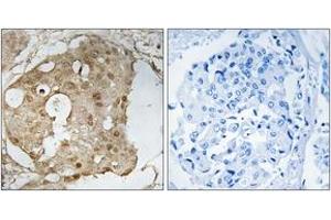 Immunohistochemistry (IHC) image for anti-Tumor Protein P53 (TP53) (AA 331-380), (pSer366) antibody (ABIN1532023)