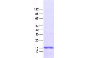 Validation with Western Blot