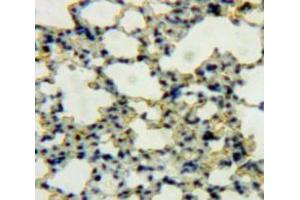 IHC-P analysis of Lung tissue, with DAB staining. (DEFB119 抗体  (AA 22-84))