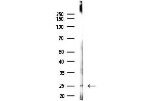 anti-Cilia and Flagella Associated Protein 299 (Cfap299) antibody