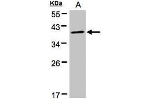 WB Image Sample(30 μg of whole cell lysate) A:HeLa S3, 12% SDS PAGE antibody diluted at 1:500 (PRKACA 抗体  (Center))