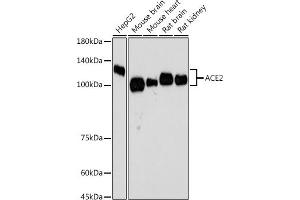 Western blot analysis of extracts of various cell lines, using  antibody  at 1:500 dilution. (ACE2 抗体)