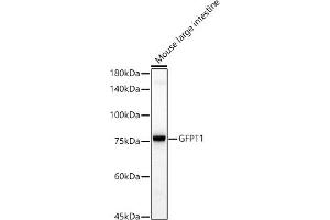 Western blot analysis of extracts of Mouse large intestine, using GFPT1 antibody (ABIN7267430) at 1:1000 dilution. (GFPT1 抗体)