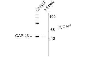 Image no. 1 for anti-Growth Associated Protein 43 (GAP43) (pSer41) antibody (ABIN372649) (GAP43 抗体  (pSer41))