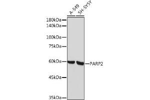 Western blot analysis of extracts of various cell lines, using P Rabbit mAb (ABIN7269441) at 1:1000 dilution. (PARP2 抗体)