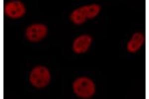 ABIN6269183 staining HeLa by IF/ICC. (ELK1 抗体  (C-Term))