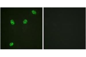 Immunofluorescence analysis of HeLa cells, using ERF (Phospho-Thr526) Antibody. (ERF 抗体  (pThr56))