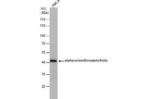 Western Blotting (WB) image for anti-Actin, alpha 2, Smooth Muscle, Aorta (ACTA2) (N-Term) antibody (ABIN2857027)