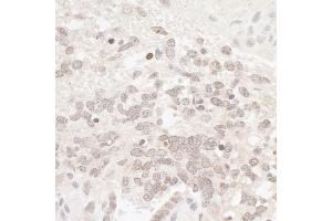 Immunohistochemistry (IHC) image for anti-Casein Kinase 2 alpha 1 (CSNK2A1) (AA 300-350) antibody (ABIN7454514) (CSNK2A1/CK II alpha 抗体  (AA 300-350))