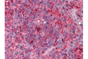 Immunohistochemical analysis of paraffin-embedded human Spleen tissues using anti-ARNTL antibody (ARNTL 抗体)