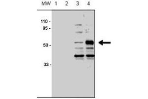 Western blot analysis of ACVRL1 polyclonal antibody  in human chondrocytes (C-28/I2 cells), transfected with empty vector (lane 1, 3) or ACVRL1 (lane 2, 4). (ACVRL1 抗体  (N-Term))