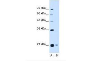 Image no. 1 for anti-Placenta-Specific 1-Like (PLAC1L) (AA 71-120) antibody (ABIN6739219) (PLAC1L 抗体  (AA 71-120))
