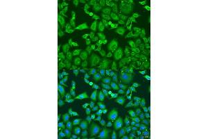 Immunofluorescence analysis of U2OS cells using KIF11 antibody. (KIF11 抗体  (AA 797-1056))