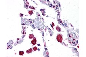 EIF2AK1 antibody was used for immunohistochemistry at a concentration of 4-8 ug/ml. (EIF2AK1 抗体  (N-Term))