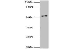 Western blot All lanes: RAD18 antibody at 2 μg/mL + COLO205 whole cell lysate Secondary Goat polyclonal to rabbit IgG at 1/10000 dilution Predicted band size: 57 kDa Observed band size: 57 kDa (RAD18 抗体  (AA 1-495))
