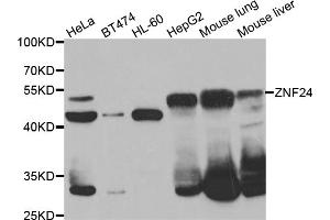 Western blot analysis of extracts of various cell lines, using ZNF24 antibody (ABIN5975578) at 1/1000 dilution. (ZNF24 抗体)