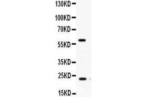 Observed bind size: 24KD,60KD (RAB11A 抗体  (C-Term))