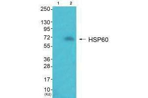 Western blot analysis of extracts from JK cells (Lane 2), using HSP60 antiobdy. (HSPD1 抗体)