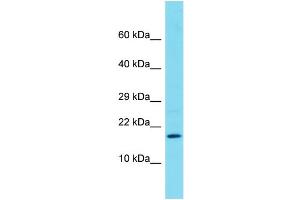 Western Blotting (WB) image for anti-Family with Sequence Similarity 183, Member B (FAM183B) (C-Term) antibody (ABIN2791535) (FAM183B 抗体  (C-Term))
