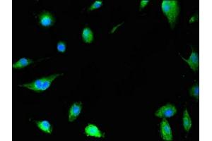 Immunofluorescent analysis of U251 cells using ABIN7155043 at dilution of 1:100 and Alexa Fluor 488-congugated AffiniPure Goat Anti-Rabbit IgG(H+L) (c-MET 抗体  (AA 83-209))