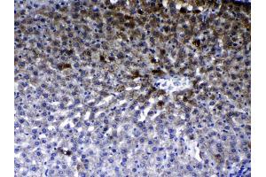 IHC analysis of ErbB 2 using anti- ErbB 2 antibody . (ErbB2/Her2 抗体  (N-Term))