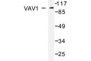 Western blot analysis of VAV1 antibody in extracts from K562 cells treated with UV 15'. (VAV1 抗体)