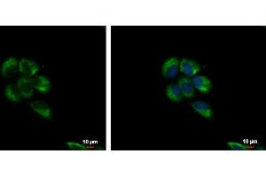 Immunofluorescence (IF) image for anti-Metadherin (MTDH) antibody (ABIN2854801)