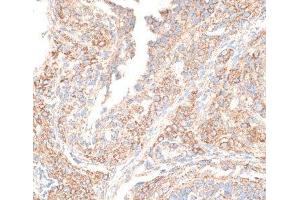 Immunohistochemistry of paraffin-embedded Rat ovary using KIF14 Polyclonal Antibody at dilution of 1:100 (40x lens). (KIF14 抗体)