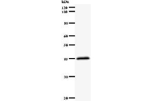 Western Blotting (WB) image for anti-Nuclear Factor (erythroid-Derived 2)-Like 2 (NFE2L2) antibody (ABIN931118) (NRF2 抗体)