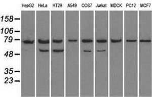 Western blot analysis of extracts (35 µg) from 9 different cell lines by using anti-HSPA9 monoclonal antibody. (HSPA9 抗体)