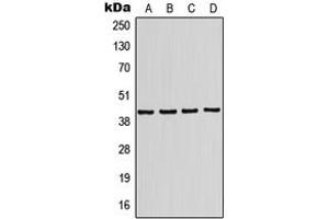 Western blot analysis of Kir4. (KCNJ10 抗体  (Center))