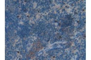 Detection of HSPBP1 in Rat Spleen Tissue using Polyclonal Antibody to Heat Shock 70 kDa Binding Protein 1 (HSPBP1)