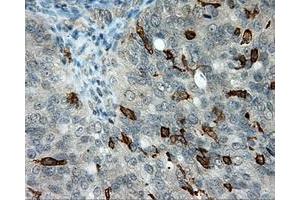 Immunohistochemical staining of paraffin-embedded Kidney tissue using anti-LIPG mouse monoclonal antibody. (LIPG 抗体)