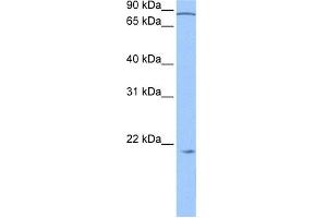 Western Blotting (WB) image for anti-Actin Related Protein 2/3 Complex, Subunit 3, 21kDa (ARPC3) (N-Term) antibody (ABIN2784768)